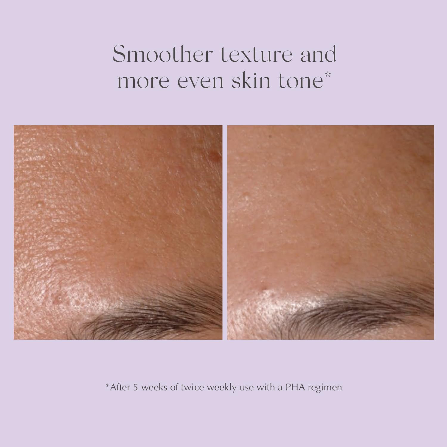 EXUVIANCE Performance Peel AP25 Starter Set, At-Home Chemical Peel, Gently Exfoliates & Refines Pores, Anti-Aging Peel, Treats Fine Lines, Wrinkles & Uneven Texture with Glycolic Acid, 2-week supply